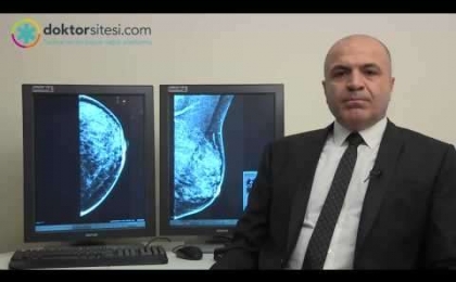 Mamografide mikrokalsifikasyon (memede kireçlenme) nedir?